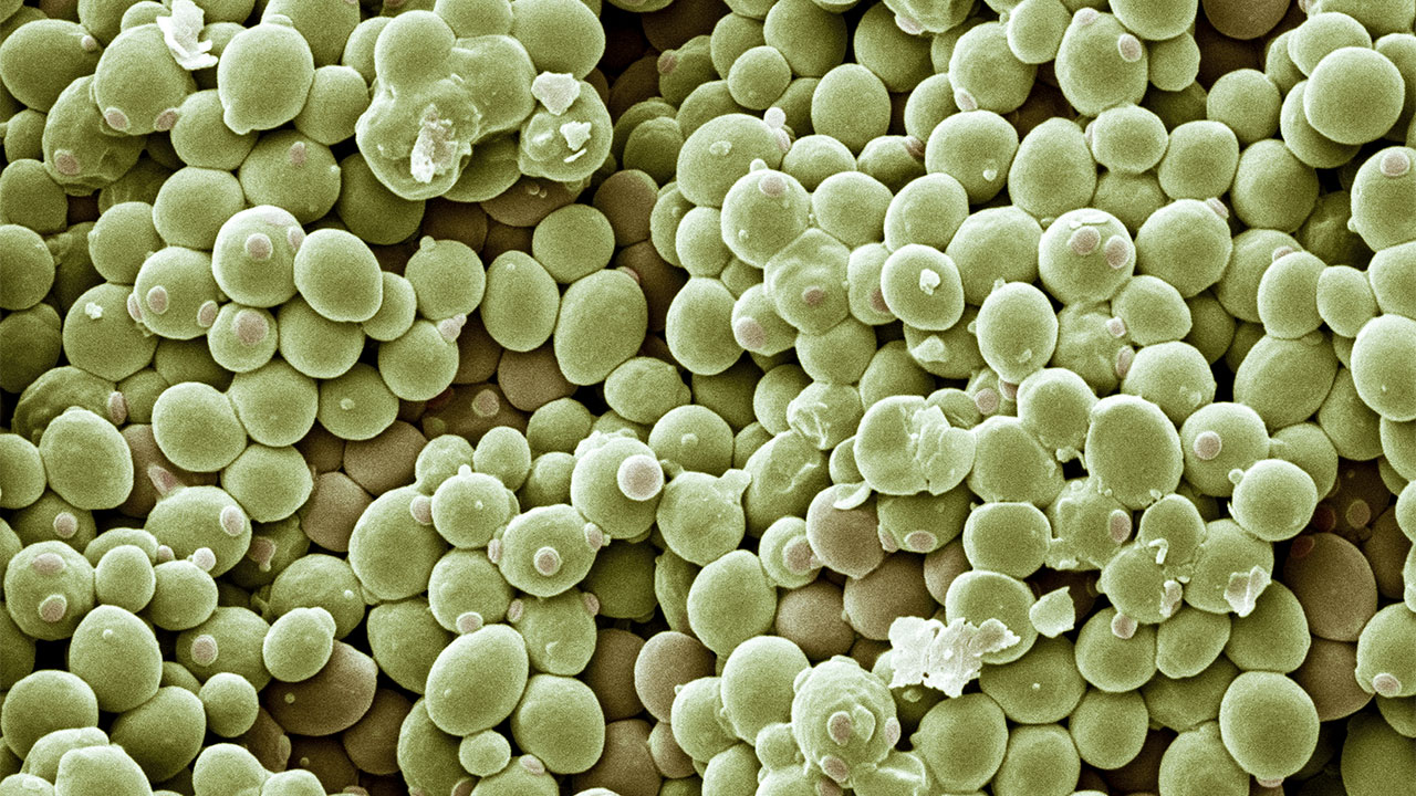 应对酵母在扩大培养中起发缓慢的专业策略